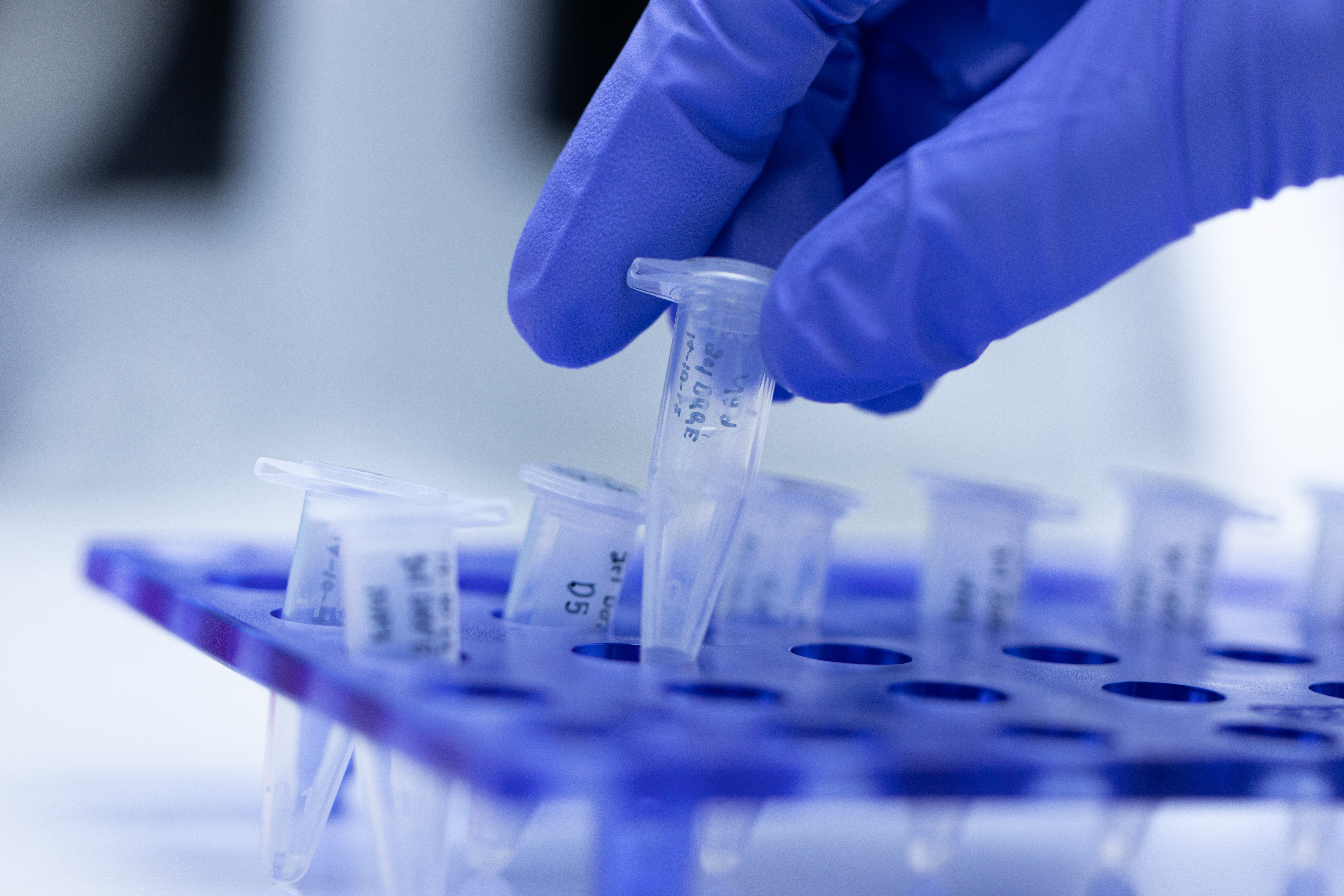 Next Day Legionella PCR Phigenics